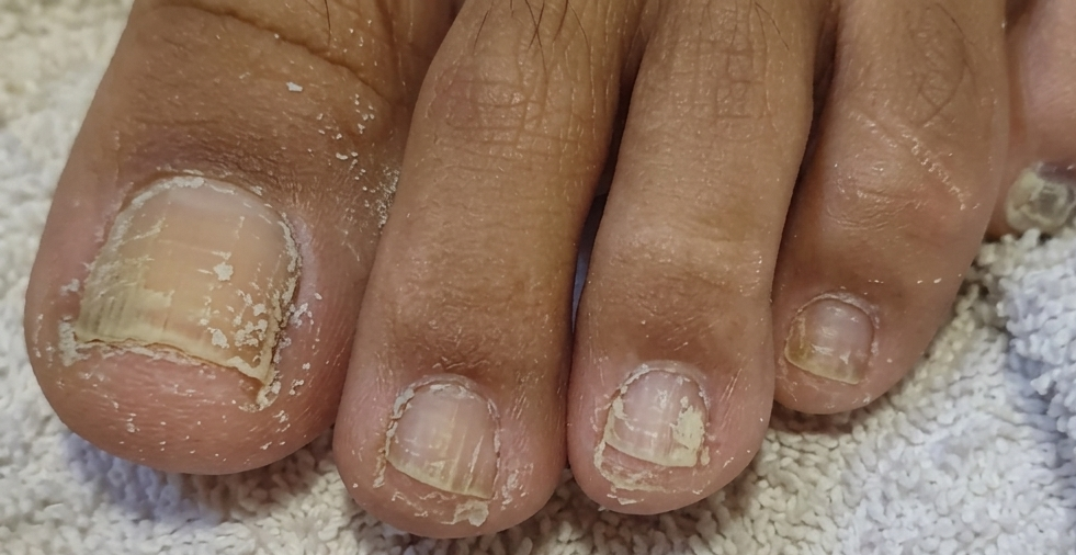 Uñas largas antes
